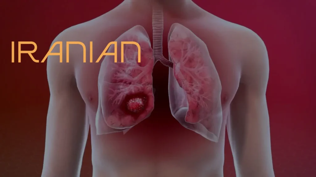 درخواست اجرای برنامه ملی غربالگری سرطان ریه در رومانی