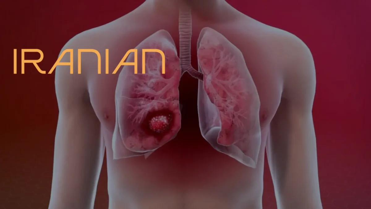 درخواست اجرای برنامه ملی غربالگری سرطان ریه در رومانی